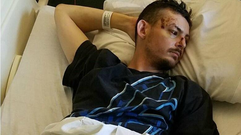 Injured bicyclist to hit-and-run driver: 'Why did you leave me there?'